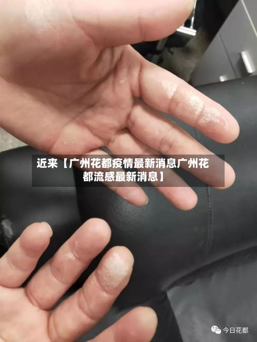 近来【广州花都疫情最新消息广州花都流感最新消息】