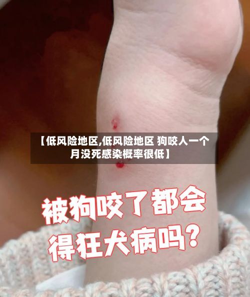 【低风险地区,低风险地区 狗咬人一个月没死感染概率很低】-第2张图片