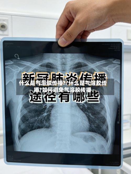 什么是气溶胶传播?/什么是气溶胶传播?如何避免气溶胶传播-第3张图片
