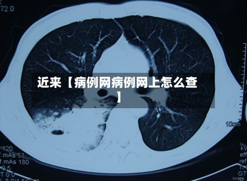 近来【病例网病例网上怎么查】-第2张图片