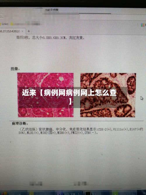 近来【病例网病例网上怎么查】-第3张图片